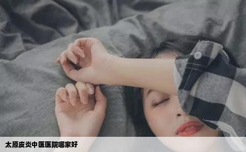 太原皮炎中医医院哪家好