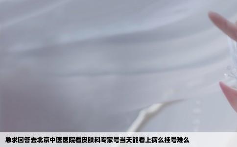 急求回答去北京中医医院看皮肤科专家号当天能看上病么挂号难么
