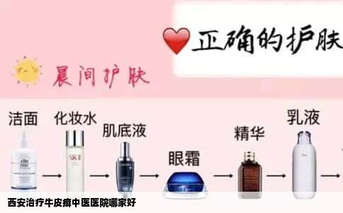 西安治疗牛皮癣中医医院哪家好
